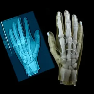 RadioMatrix